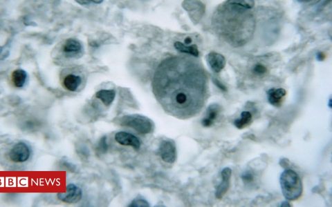 Mind-taking in amoeba: Warning issued in Florida just after rare an infection circumstance